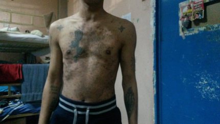 Φωτογραφία από την "ιατρική μονάδα" των φυλακών Κορυδαλλού. Πηγή http://twitter.com/kolastirio | https://www.facebook.com/kolastiriokratoumenon